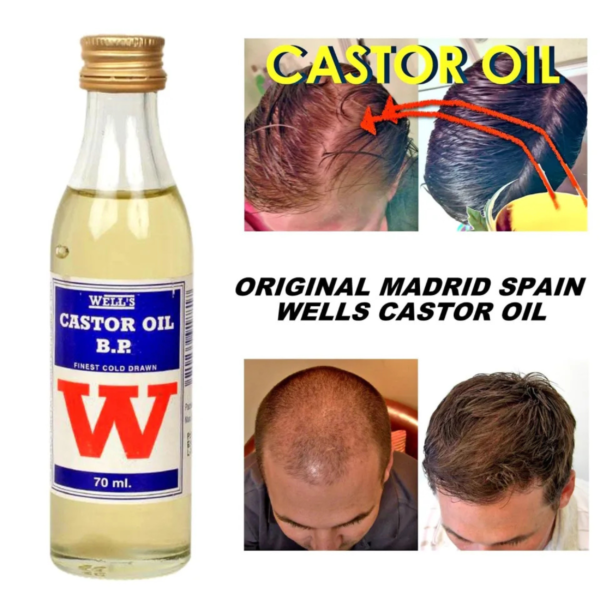 Well's Castor Oil 70ml - Image 2