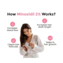 Dr. Reddy’s Mintop Forte 2% Minoxidil Solution 120ml – Effective Hair Regrowth Treatment for Women and Sensitive Scalps