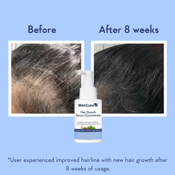 WishCare Hair Growth Serum 30ml - Image 2