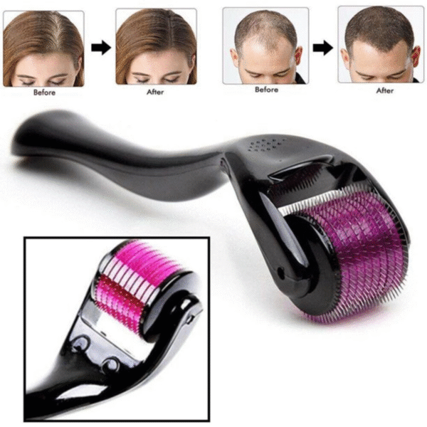 Derma Roller System – Professional Microneedling Tool for Face and Scalp